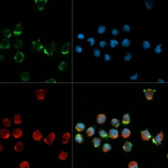 IHC - Cluster of Differentiation 34 (CD34)